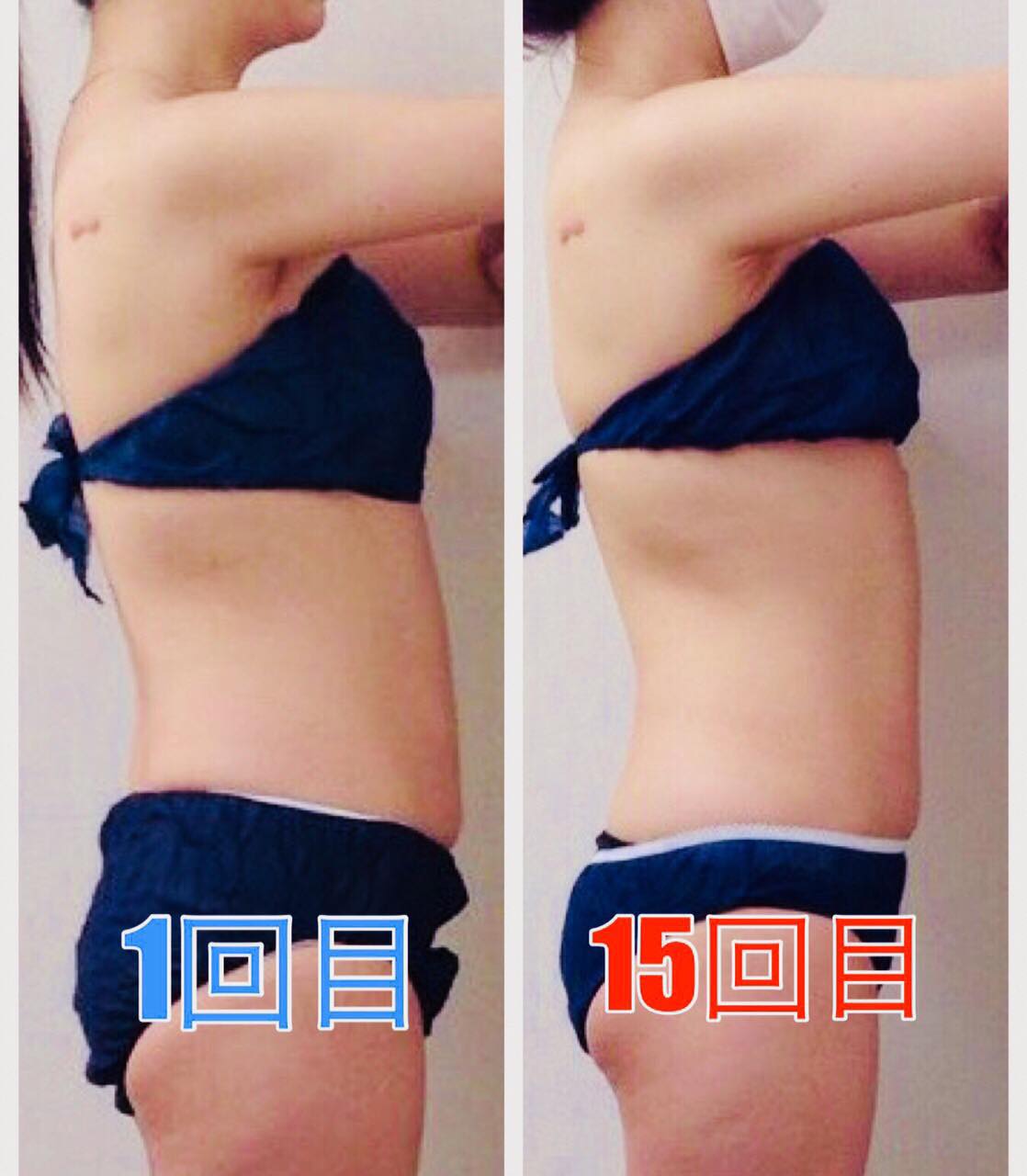 ビフォーアフター