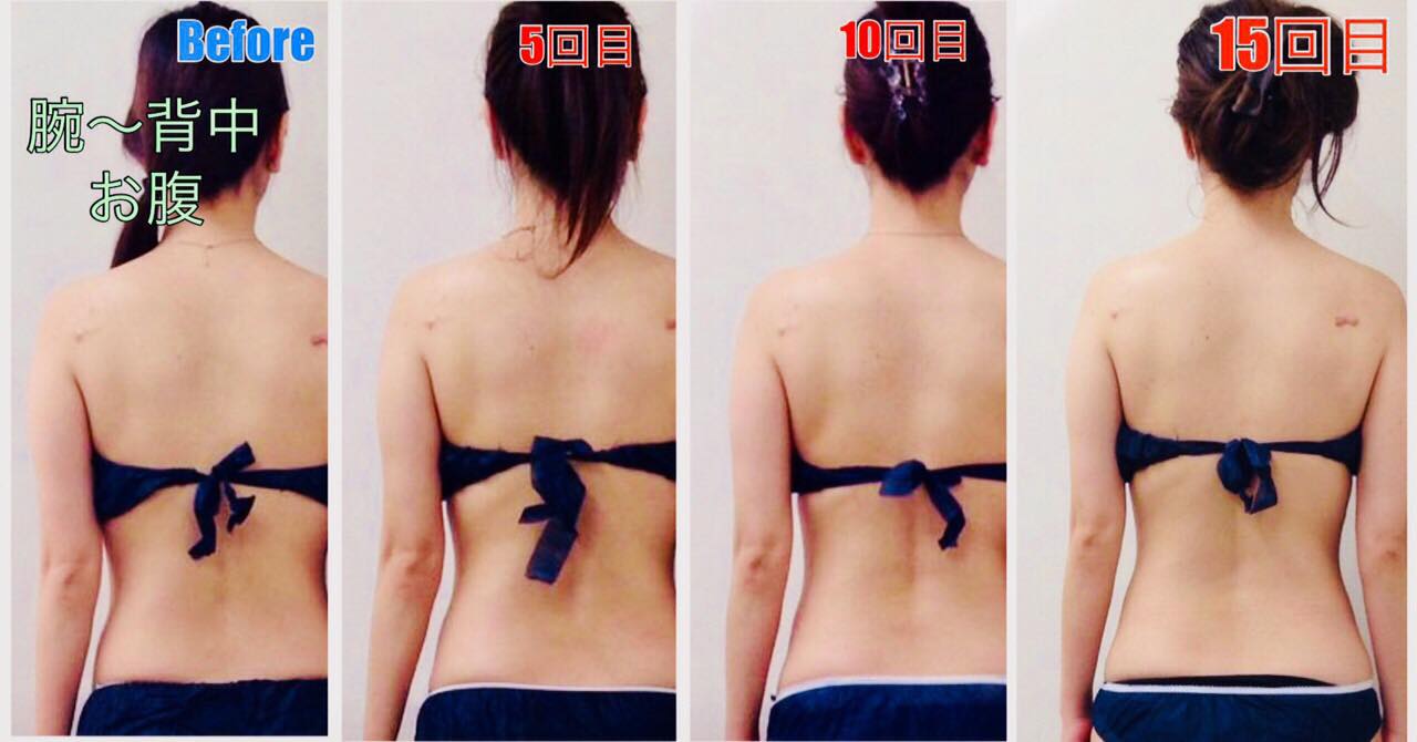 ビフォーアフター